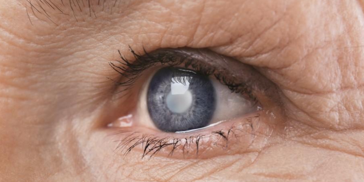 Glaucoma Service