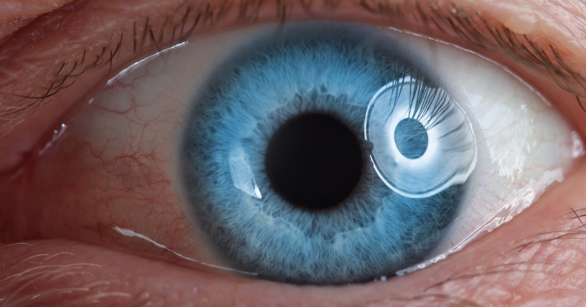 Retinal Treatment